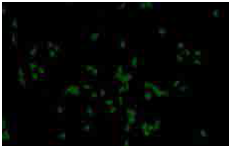 人iPS细胞来源的胆碱神经元祖细胞                              ReproNeuro Ach™ kit