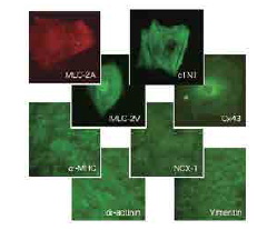 人iPS细胞来源的心肌细胞，用于高通量分析                              ReproCardio 2