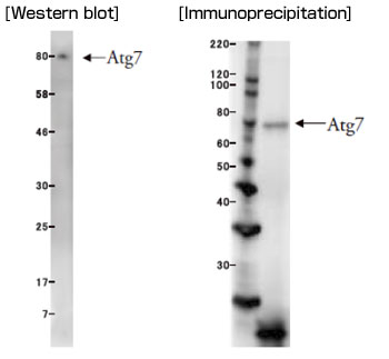 抗Atg7单克隆抗体（克隆号：ATG7-2）                              Anti Atg7 (Clone: ATG7-2) Monoclonal antibody