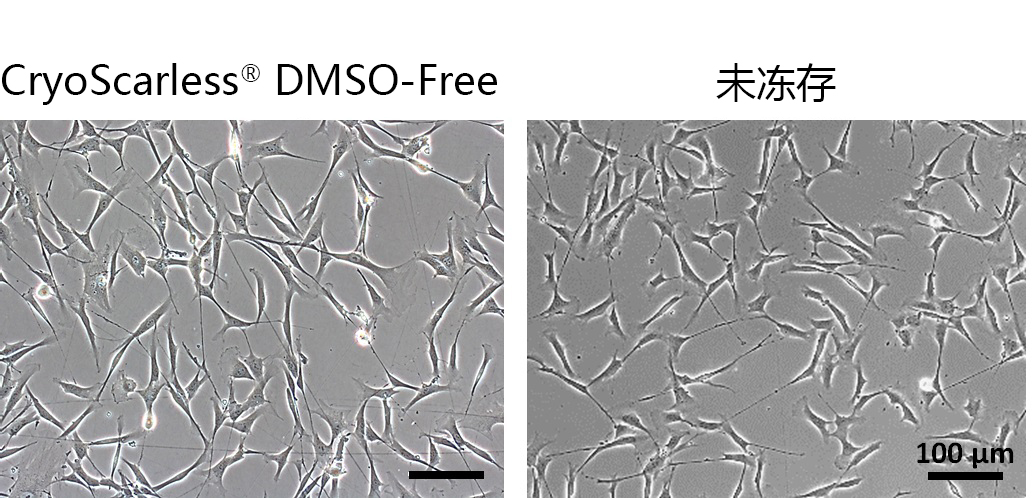 CryoScarless ® DMSO-Free                              高存活率细胞冻存液