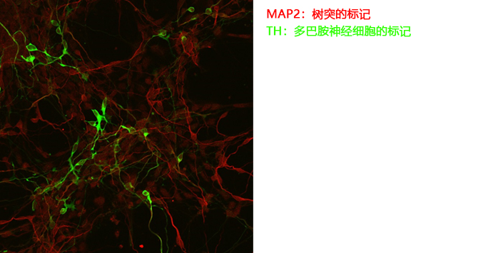神经细胞用培养基