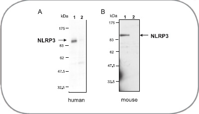 NLRP3抗体                              anti-NLRP3/NALP3, mAb