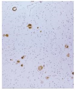 β淀粉样蛋白-免疫组织染色试剂盒                              Amyloid β-Protein Immunohistostain Kit