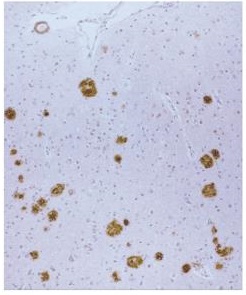 β淀粉样蛋白-免疫组织染色试剂盒                              Amyloid β-Protein Immunohistostain Kit