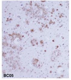 β淀粉样蛋白-免疫组织染色试剂盒                              Amyloid β-Protein Immunohistostain Kit