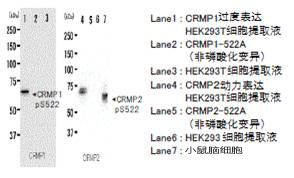 抗磷酸化CRMP1/2（Ser522），兔                              Anti Phosphorylated CRMP1/2 (Ser522),   Rabbit