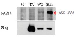 抗磷酸化ASK1，单克隆抗体                              Anti Phosphorylated ASK1, Monoclonal   Antibody