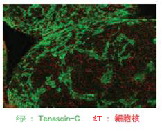 抗人肌腱蛋白-C，大鼠单克隆抗体                              Anti HumanTenascin-C, Rat Monoclonal   Antibody