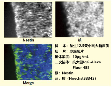 抗小鼠Nestin，大鼠单克隆抗体（7A3）                              神经干细胞标记物