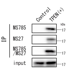 Anti-SOD1（ALS-related mutants）Cocktail，Human，Rat-Mono （MS785/MS27）                              全面检测ALS相关SOD1突变体的混合型抗体