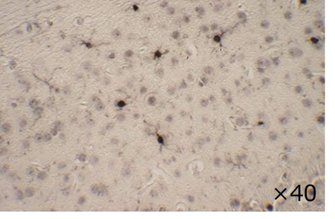 抗Iba1，山羊多克隆抗体                              小胶质细胞标记