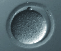 使用细胞融合试剂 GenomONE™-CF进行核移植的方法