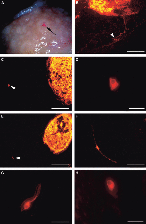 DiI (DiIC18(3)) 细胞膜橙红色荧光探针