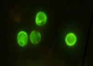 荧光素标记抗隐孢子虫抗体(Fluorescein-labeled Anti-CryptosporidTBS22111