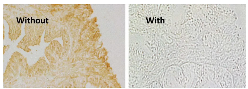 蛋白质封闭解决方案