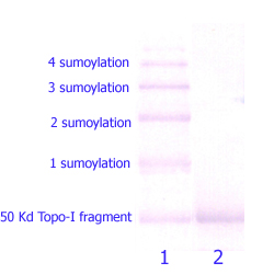 laebio检测试剂盒:Sumoylation Control Kits简述
