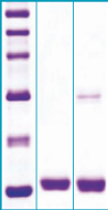 BioVendor 脂肪细胞型脂肪酸结合蛋白RD172036100